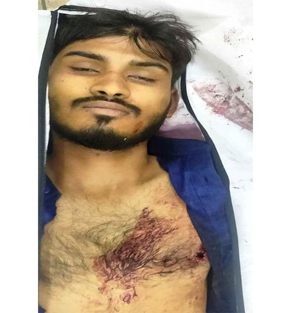 র‌্যাবের সাথে বন্দুকযুদ্ধে ৩ মাদক ব্যবসায়ী নিহত