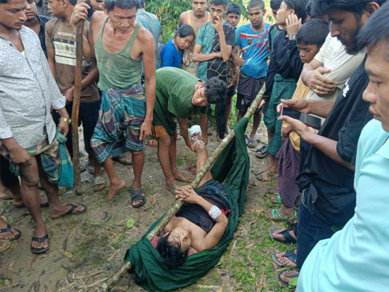 নাইক্ষ্যংছড়ি সীমান্তে মিয়ানমারের অভ্যন্তরে বিস্ফোরণে এবার মিয়ানমারে নাগরিকের বাম পা বিচ্ছিন্ন